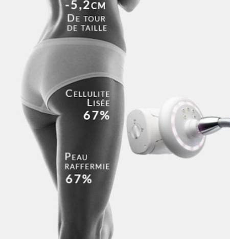 Comment avoir de meilleurs résultats après massages lpg® sculptants de Aix-en-provence ?