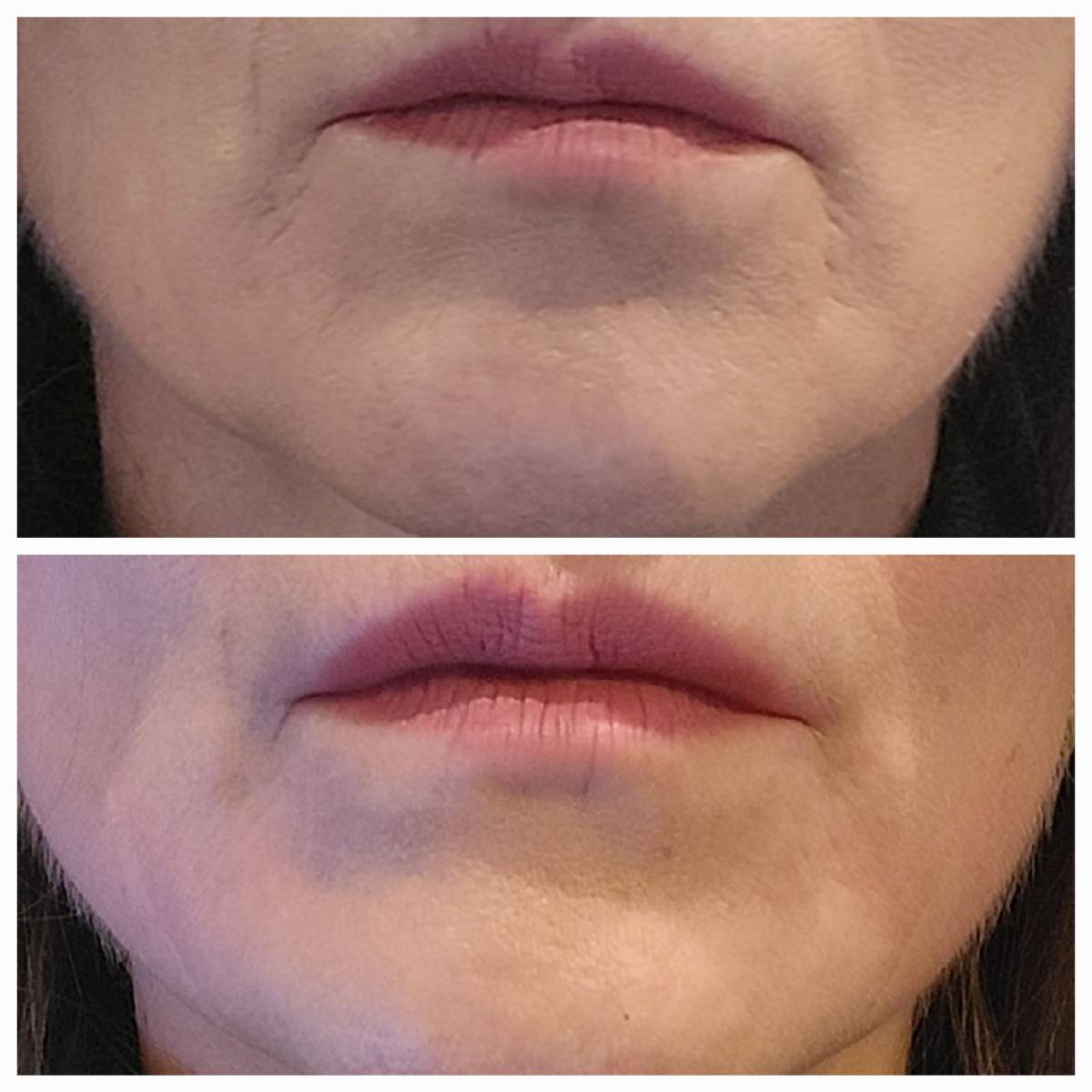  lisser les rides en 20 minutes chrono !