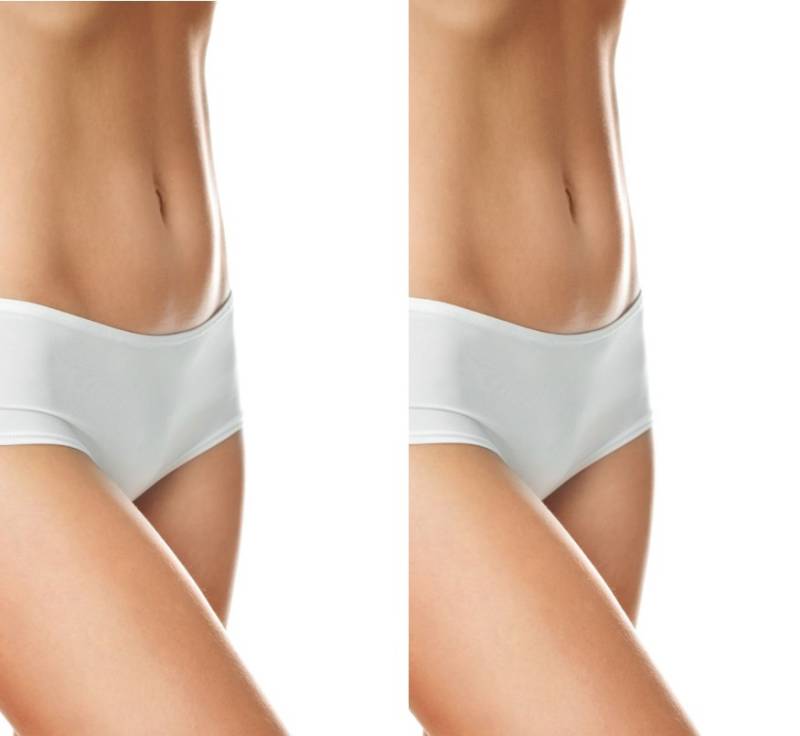 Forfait LPG à petit prix à Aix-en-Provence: une cure LPG exclusive pour préparer votre corps à la nouvelle saison